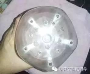 糖尿病豆芽怎么做(糖尿病能否吃豆芽)