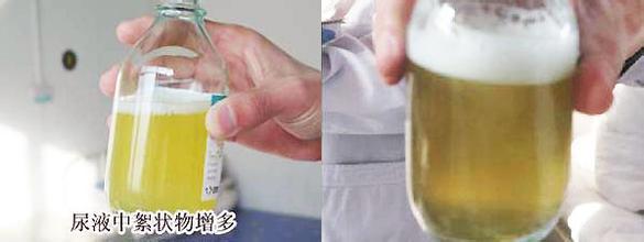 糖尿病是试纸(糖尿病试纸哪个牌子好)