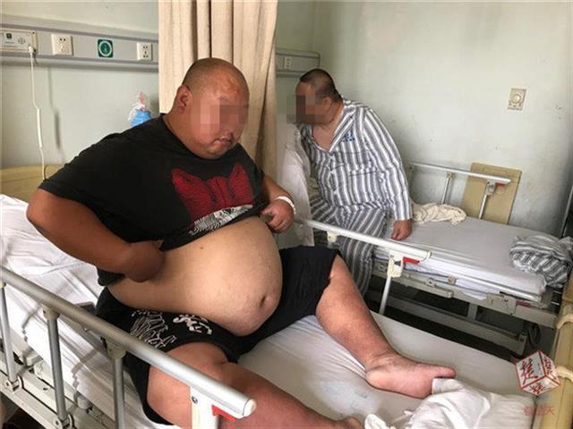 中央性肥胖(中央型肥胖定义)
