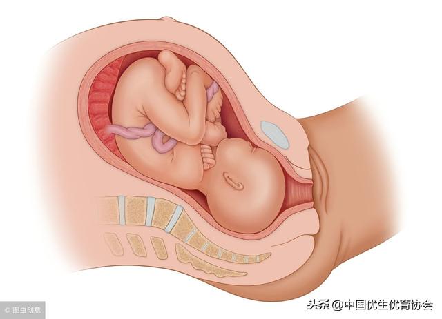 妊娠糖尿病过了预产期(妊娠糖尿病过了两年还能好吗)