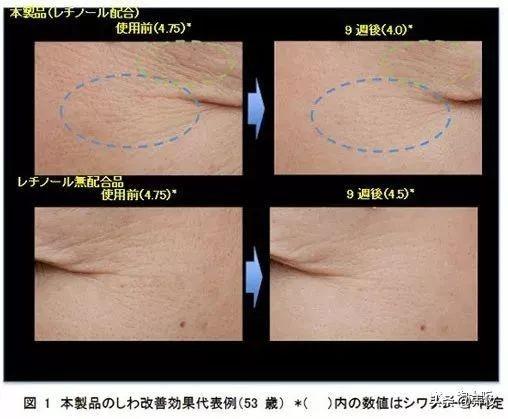什么眼霜去皱效果好，真正可以去皱的眼霜（良心推荐这几款超火爆的抗老眼霜）