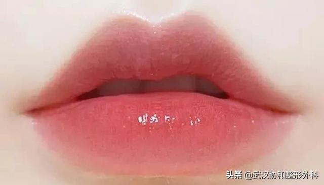 常见的唇部整形都有哪些，唇部整形有什么方法