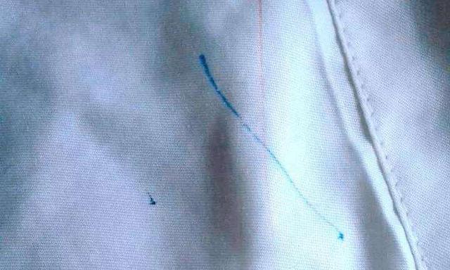 衣服上的顽固污渍怎么去除，衣服上顽固污渍怎么去除