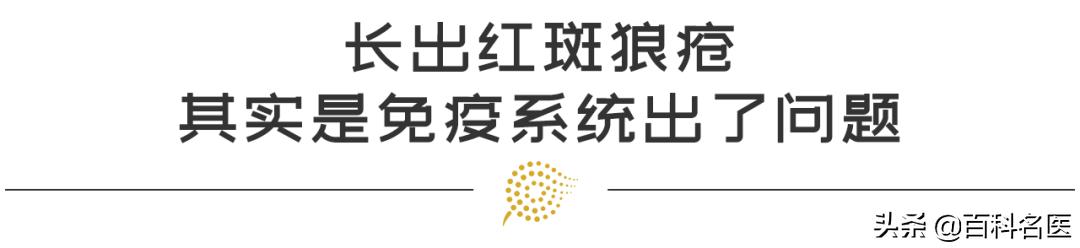 红斑狼疮是免疫系统太强还是太弱，红斑狼疮是因为免疫系统太强吗（是免疫系统这个细胞在“作妖”）