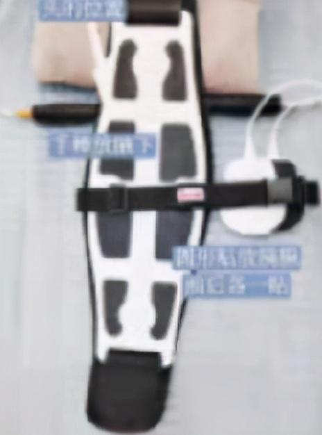 春季开背管理方法，3个管理方法很重要