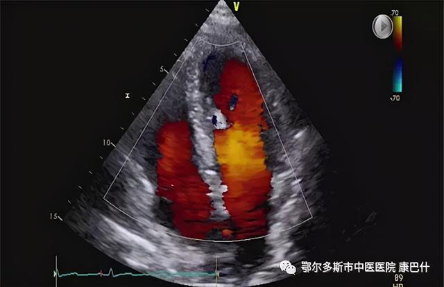 超声检查基本原理，超声波原理？