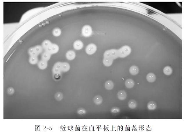 嗜热链球菌是什么食品添加剂，记住这个数字，给娃挑选真酸奶