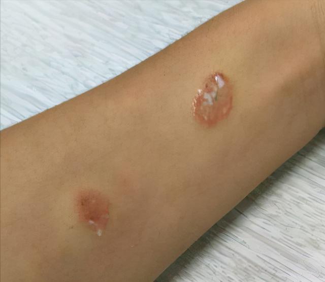 猫猫为啥会有皮肤病，猫猫疾病四你对猫猫的疾病知多少