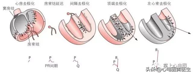 通俗易懂的心电图基础介绍，零基础都秒懂：学习心电图