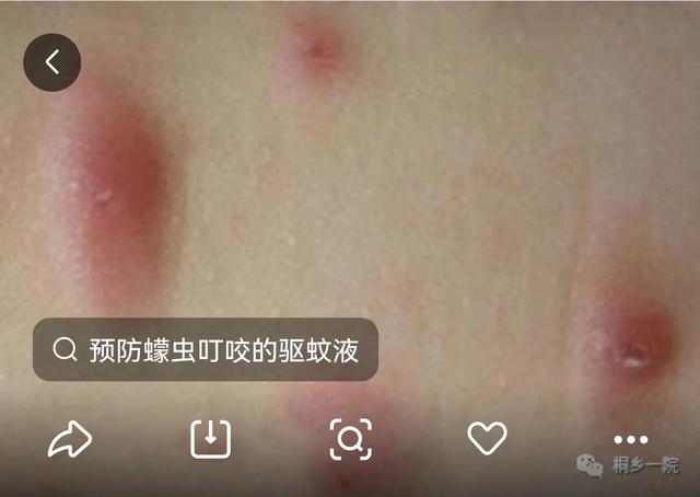 被蠓虫咬了怎么好得快，不小心被蠓虫“伏击”