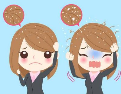 去屑有什么小技巧，去屑小妙招你值得拥有