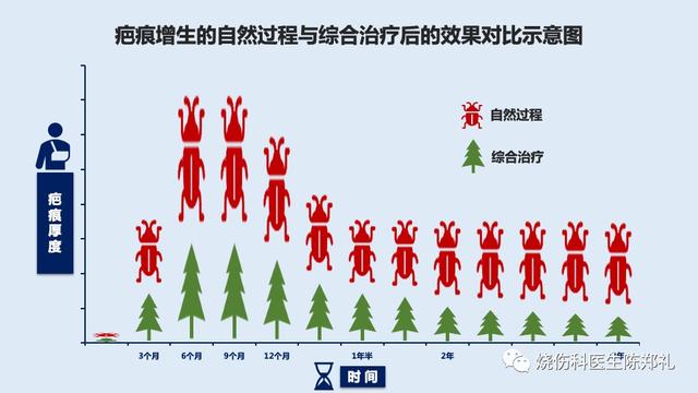 肥胖纹疤痕贴(肥胖纹疤痕贴管用吗)