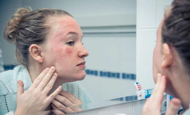 红霉素软膏的禁忌，红霉素软膏的功效及注意事项