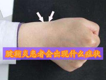 腱鞘炎是什么症状，腱鞘炎会有怎样的症状（有一种爱叫“妈妈手”有一种痛叫“腱鞘炎”）