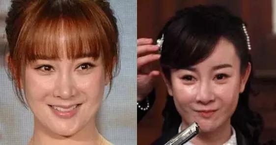 张檬都整了哪里，张檬居然亲口承认自己是小三了