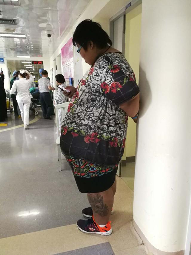 剖肥胖