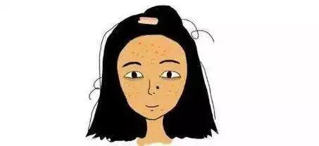 上火严重下火最快的办法，送你几招降火方法，比吃药靠谱