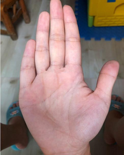 手掌大手指短运气好吗，手掌饱满有肉的人