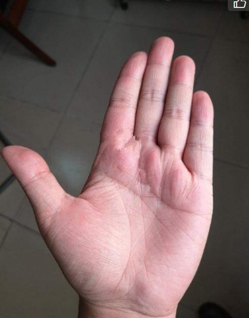 手掌大手指短运气好吗，手掌饱满有肉的人