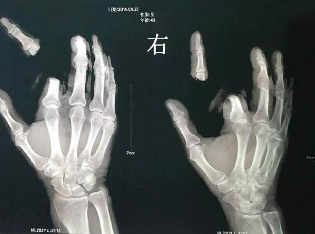 十种毒性动物，有剧毒能毁容被谣言妖魔化的动物界