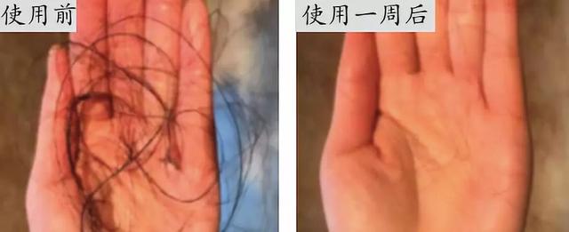 不用洗发水可以改善头发枯燥，应该如何修复受损的头发