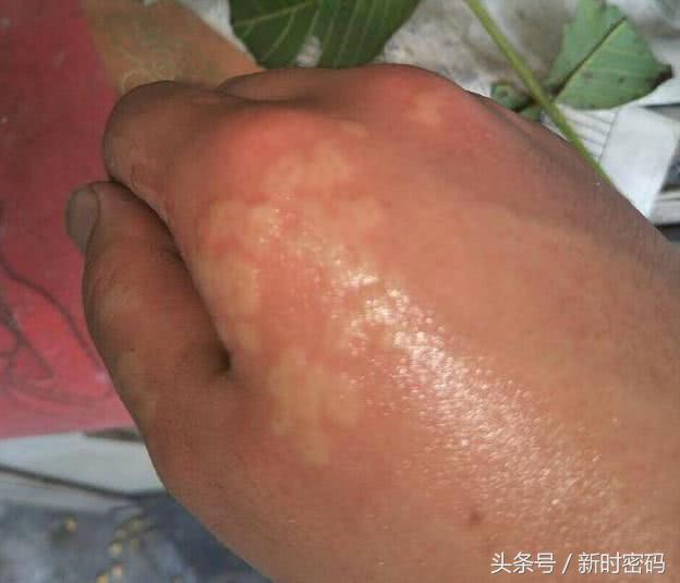 农村常见的10种野生食物，图6名字容易被误会