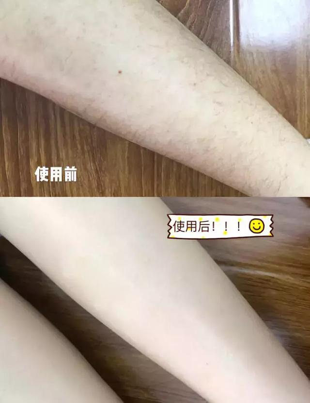 日本cm脱毛膏测评，这个夏天，先脱为敬