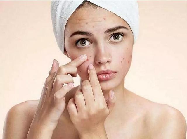 青春痘留疤痕多久能消除，青春痘疤痕小百科