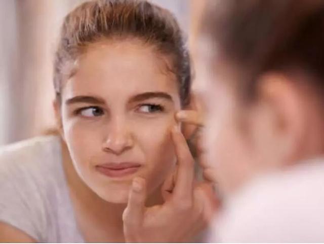 青春痘留疤痕多久能消除，青春痘疤痕小百科