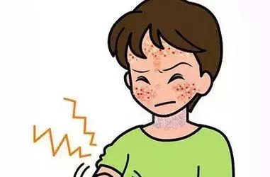 日光过敏皮炎不可以吃什么，一晒太阳就过敏