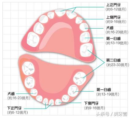 虎牙正确矫正方法，畸形的虎牙必需及时矫正