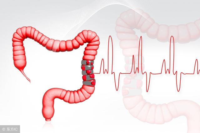 做排粪造影能发现什么，排粪造影检查的临床意义是什么