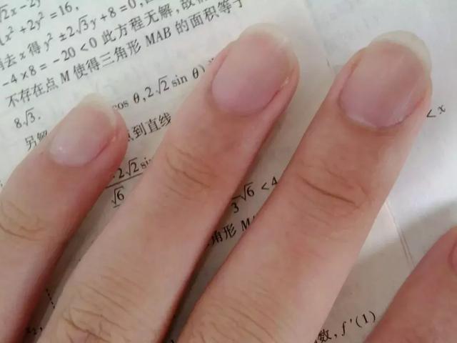鸡屎糖尿病(糖鸡屎治疗方法)