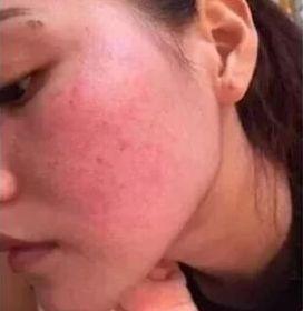 黄金抗皱系列，有了全世界3秒卖一瓶的