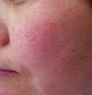 黄金抗皱系列，有了全世界3秒卖一瓶的