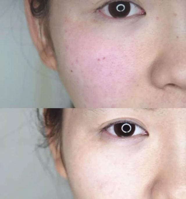 黄金抗皱系列，有了全世界3秒卖一瓶的