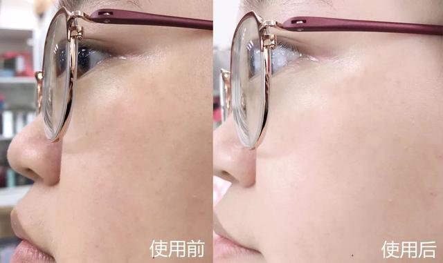 黄金抗皱系列，有了全世界3秒卖一瓶的