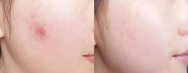 黄金抗皱系列，有了全世界3秒卖一瓶的