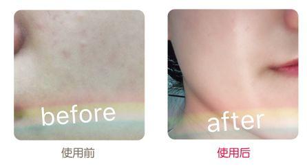 黄金抗皱系列，有了全世界3秒卖一瓶的