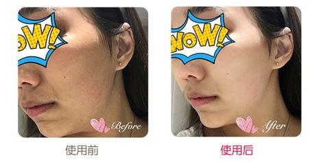 黄金抗皱系列，有了全世界3秒卖一瓶的