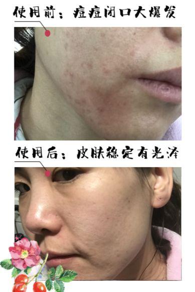 黄金抗皱系列，有了全世界3秒卖一瓶的