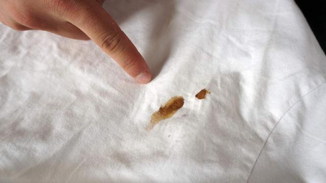 衣服上的顽固污渍怎么去除，衣服上顽固污渍怎么去除