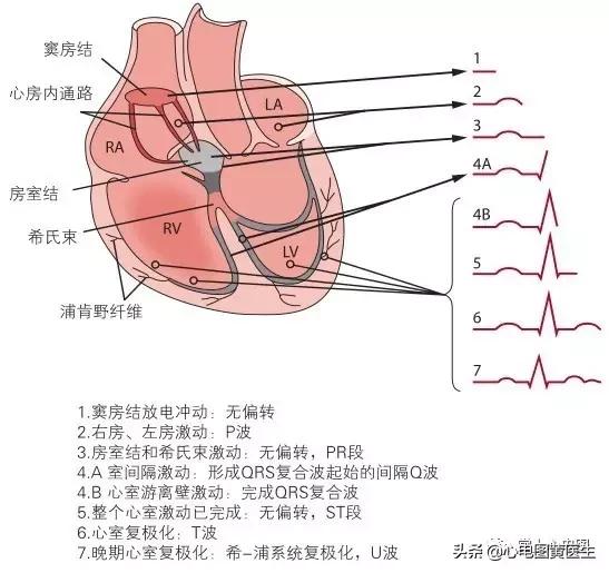 通俗易懂的心电图基础介绍，零基础都秒懂：学习心电图