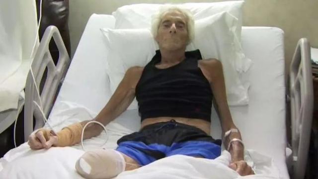 食肉菌感染不可忽视，被食肉菌感染的人