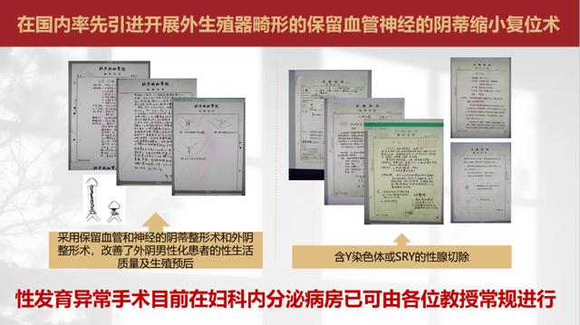 如何提高妇科cmi值，协和主任话科史