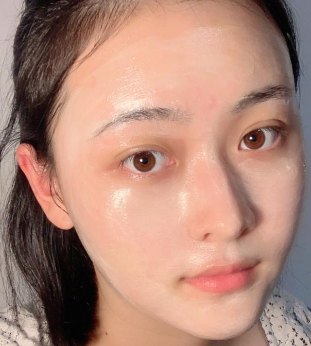 长闭口粉刺的主要原因，闭口粉刺是什么原因产生的