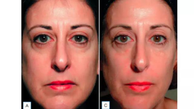 立马见效脸变小的方法，四招让你快速瘦脸