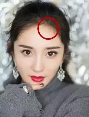 如何降低发际线，如何自然降低发际线（让你改头换面）