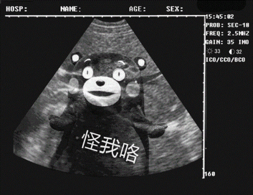 肥胖纹和妊娠纹的区别(肥胖纹和妊娠纹是一个东西吗)