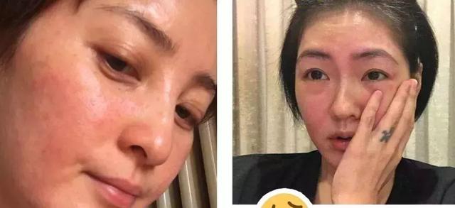 皮肤过敏用什么化妆品，抗敏修护保湿护肤品排行榜10强